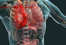 COVID Postmortem Finds ‘Viral RNA In Nearly All Organs’ & Pakistan Blocks SIM Cards Of Unvaxxed