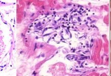 Vascular and organ damage induced by mRNA vaccines: irrefutable proof of causality