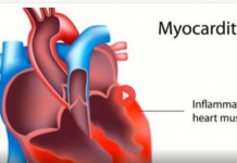 Dr. Robert Malone, Dr. Kirk Milhoan: 50% Of Injected Athletes Likely Have Undiagnosed Myocarditis