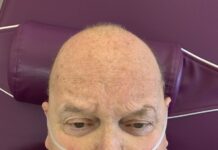 Pro-vax UK radio host ‘excited’ about 3rd jab now hospitalized with ‘lungs full of blood clots’