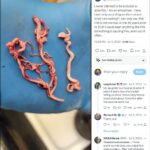 blood clots images now