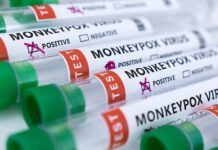 Monkeypox? Shingles? Sudden Adult Death Syndrome? Hepatitis? Something is very wrong and it’s due to the Covid Jabs