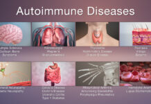 RFK Jr.: “Where is all the autoimmune diseases coming from? If it’s not the vaccines, then where is it coming from?