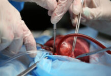 Canada is Turning Its Assisted Suicide Regime into an Organ Donation Supply Chain