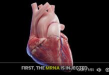 COVID-19 mRNA Injections Can Cause Sudden Death Years After Injection