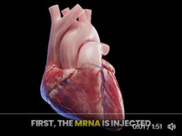 COVID-19 mRNA Injections Can Cause Sudden Death Years After Injection