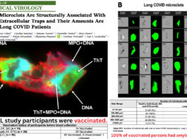 Prion-Like AMYLOID Microclots Found in 100% of the COVID VACCINATED